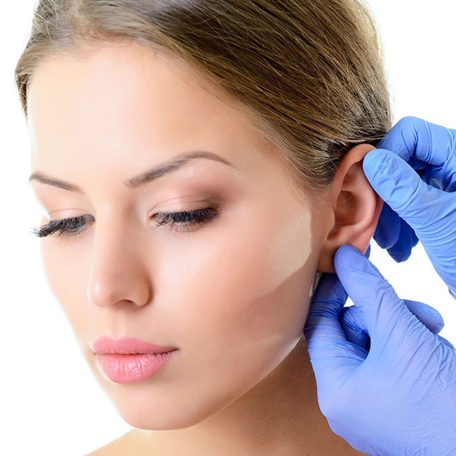 Ear Surgery-Aesthete Clinic